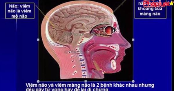 Coi chừng “cơn lốc” viêm não