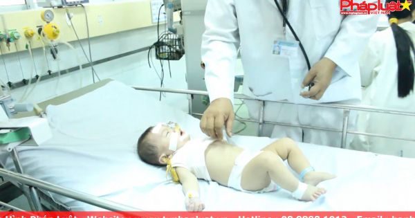 Cảnh báo di chứng động kinh sau sốt cao và co giật