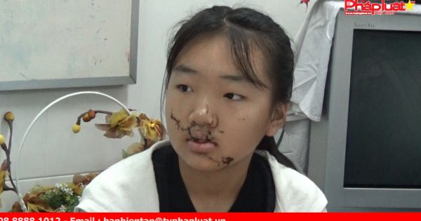 Bệnh viện Nhi đồng 1 TPHCM 