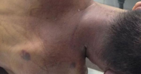 GĐ Công an Ninh Thuận lên tiếng về vụ tử vong nghi bị nhục hình