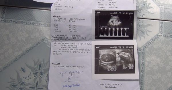 Điều tra vụ án nữ sinh lớp 9 có bầu 5 tháng vì bị người quen hiếp dâm tại phòng trọ