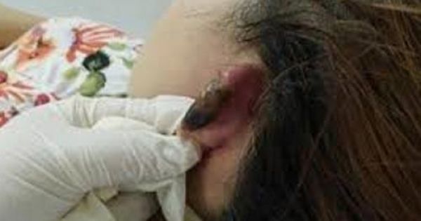 Bình Phước: Một người phụ nữ bị xẻo tai vì khất nợ 20 triệu đồng