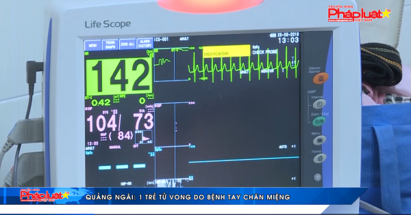 Quảng Ngãi: 1 trẻ tử vong do bệnh tay chân miệng