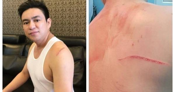 Vụ ông Chiêm Quốc Thái bị chém: Không khởi tố nữ bác sĩ