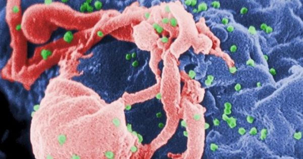 Thêm bệnh nhân thứ 3 chữa khỏi HIV