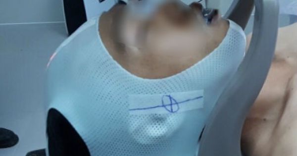 TP HCM: Tin vui cho bệnh nhân ung thư