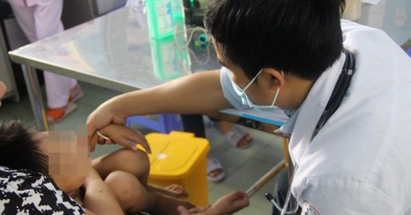 Thông tin mới về bệnh sởi, sốt xuất huyết, tay chân miệng