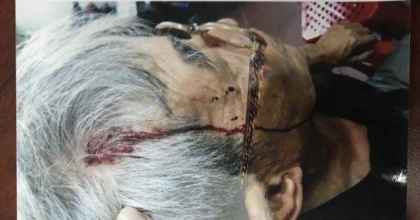 Quận 11: Xác định hành vi và đối tượng gây án nhưng không điều tra