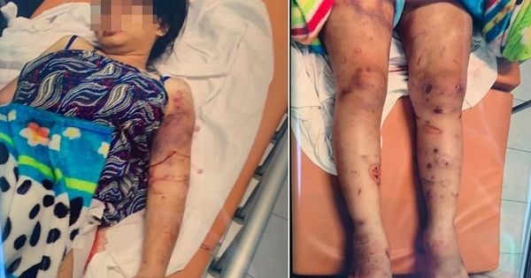 Khởi tố bị can, bắt tạm giam kẻ tra tấn man rợ cô gái 18 tuổi ở Bình Chánh