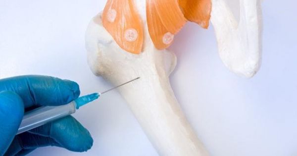 Nga thử nghiệm cấy ghép xương bằng kỹ thuật tế bào thế hệ mới