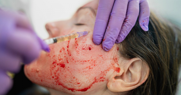 Phương pháp làm đẹp 