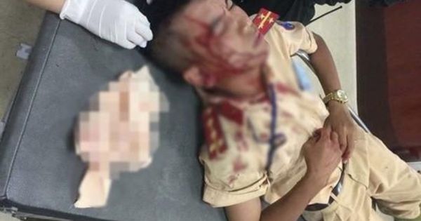 75,9% trường hợp chống đối cảnh sát giao thông là lao động phổ thông