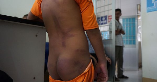 Xác định nguyên nhân 4 học sinh tiểu học ở Cà Mau bị bạo hành