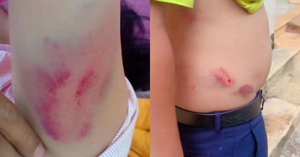 Chánh văn phòng Huyện ủy đánh tài xế nhập viện