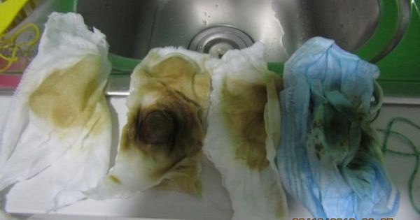 Dân chung cư ở TP.HCM hoang mang vì nước có màu, gây ghẻ ngứa