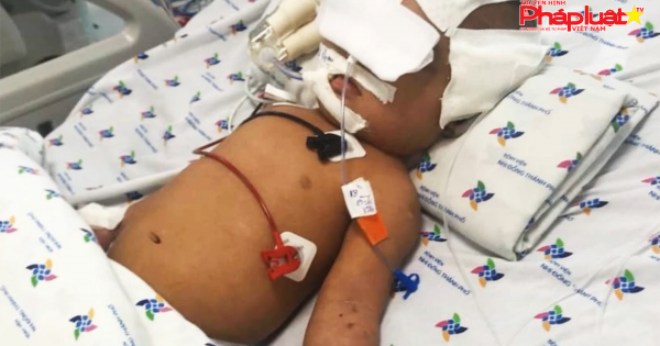 Đề nghị khởi tố vụ bé 8 tháng tuổi bị chấn thương sọ não ngày đầu đi học