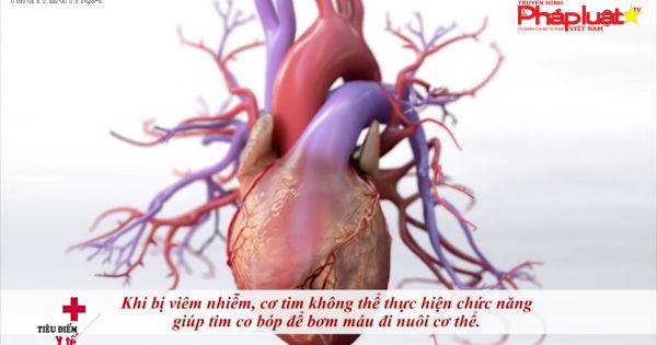 Điều tra dịch tễ sau thông tin 'virus lạ gây tử vong nhanh'