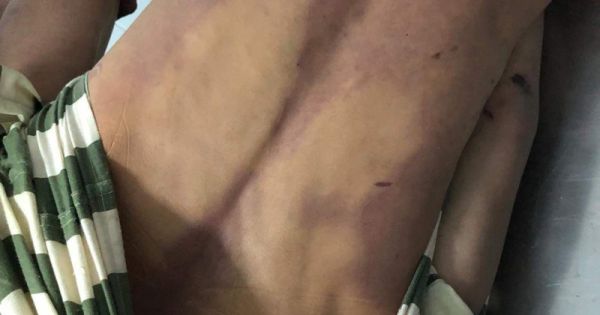 Nam thanh niên chết ở nhà tạm giữ công an ở Đồng Nai, khắp người bầm tím