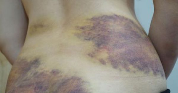 Bộ LĐTB & XH chỉ đạo xử lý nghiêm kẻ bạo hành vợ ở Tây Ninh