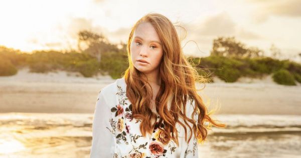 Người mẫu mắc hội chứng Down không thể ký hợp đồng với công ty quản lý cao cấp