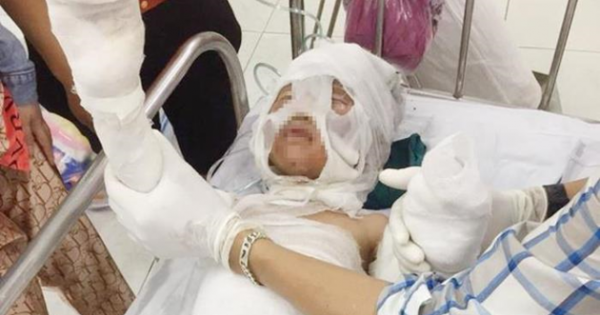 Khởi tố vụ án dì ruột đốt cháu vì không được trả nợ