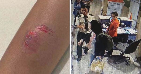 Nữ hành khách cắn nhân viên hàng không trong khi tranh cãi về hành lý quá cân