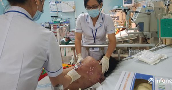 Đồng Nai: Nữ tiếp viên tố bị chủ quán cà phê chích điện, tra tấn dã man