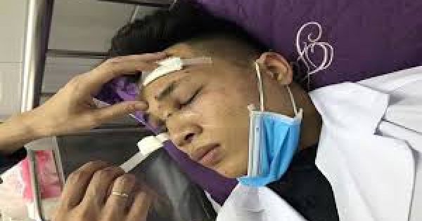 Bộ Y tế vào cuộc vụ bác sĩ bị đánh gãy sống mũi ở Hải Dương