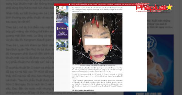 Sự thật về sự cố liệt dây thần kinh số 7 sau phẫu thuật tại Thẩm Mỹ viện Kangnam