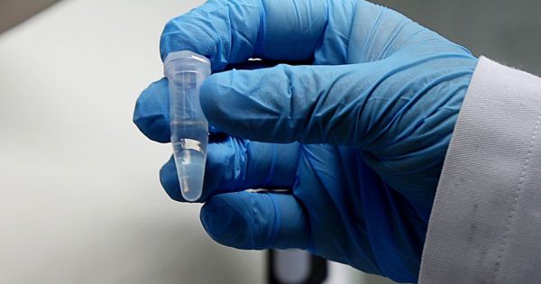 Bộ Y tế không cho phép xét nghiệm Covid-19 lấy giá dịch vụ theo yêu cầu