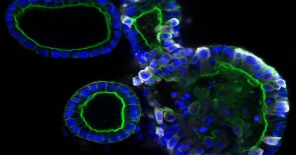 Ảnh chụp nCoV nhân lên trong tế bào ruột