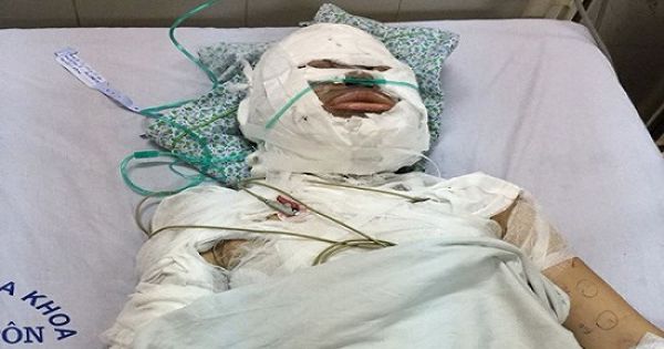 Nam công nhân bị tưới xăng đốt trước cổng khu công nghiệp