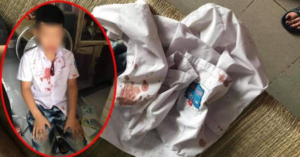 Bắt tạm giữ hình sự vị phụ huynh hành hung học sinh lớp 1 nhập viện ở Hoà Bình