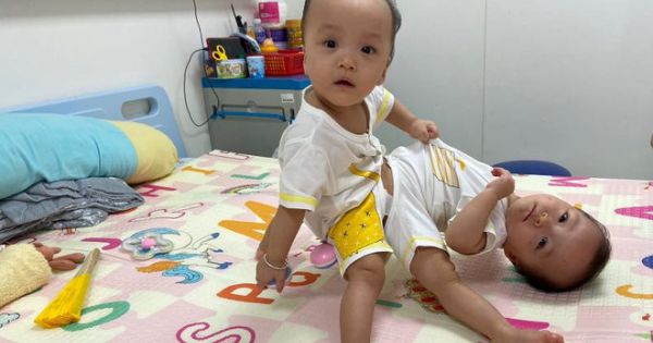 Tách rời thành công 2 bé gái song sinh, tiếp tục chuyển sang giai đoạn chỉnh, tạo hình các cơ quan