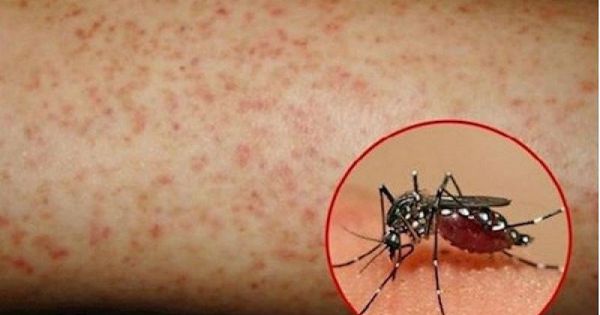 Hà Nội có công văn khẩn tăng cường phòng, chống sốt xuất huyết sau khi có ca bệnh tử vong