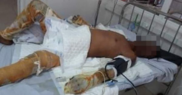 Bắt đối tượng đổ xăng để phóng khiến 4 người bị thương tại Phú Yên