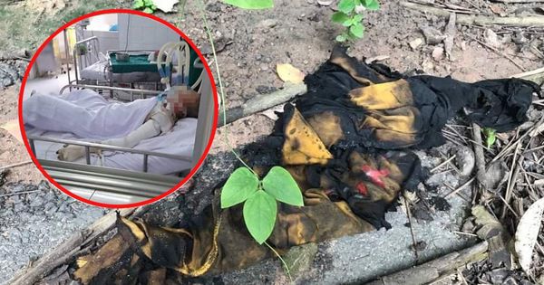 Thiếu nữ 15 tuổi bị bạn trai tưới xăng đốt đã tử vong tại Bình Dương