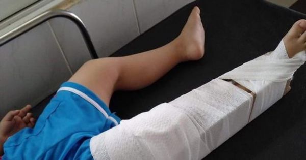 Bị ong đốt, 16 học sinh nhập viện