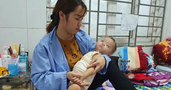 Chữa bỏng 25 triệu với thầy lang, bé trai bị hoại tử phải ghép da