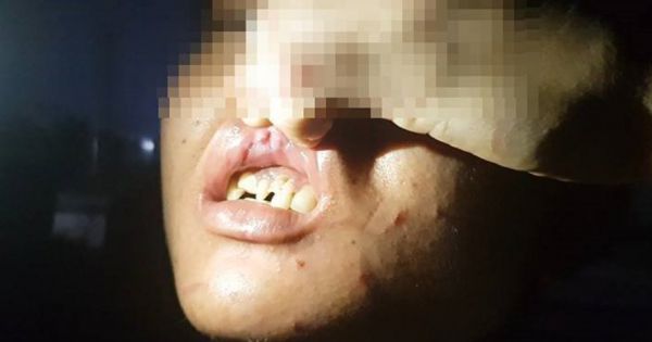 Chủ quán bánh xèo bị tố hành hạ nhân viên tại Bắc Ninh