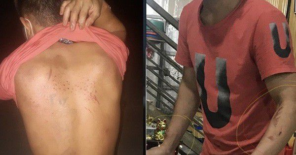 Chủ tịch Bắc Ninh yêu cầu điều tra vụ chủ quán bánh xèo Miền Trung bạo hành 2 nhân viên