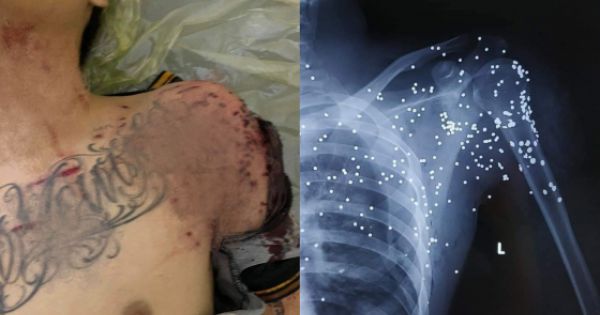 Vụ nổ súng tại trạm BOT ở Thái Bình, đối tượng gây án đã ra đầu thú