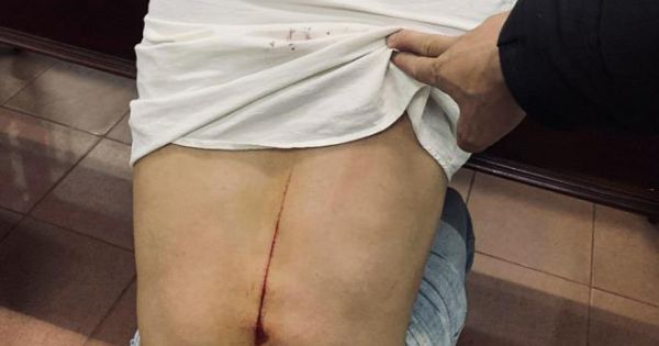 Một phóng viên bị chém nghi do báo tin liên quan đến gỗ lậu