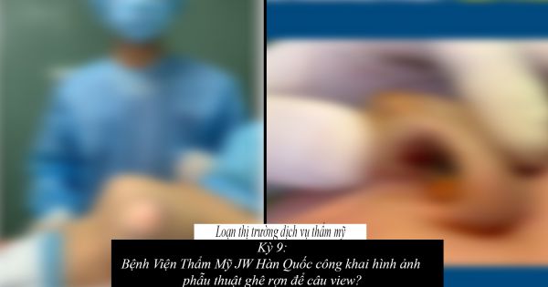 Loạn thị trường dịch vụ thẩm mỹ, làm đẹp- kỳ 9: Bệnh Viện Thẩm Mỹ JW Hàn Quốc công khai hình ảnh phẫu thuật ghê rợn để câu view?