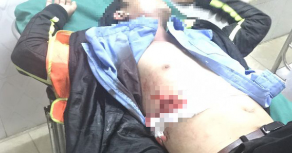 Một kẻ chạy xe máy gây sự, đâm bảo vệ trạm thu phí trọng thương tại Khánh Hòa