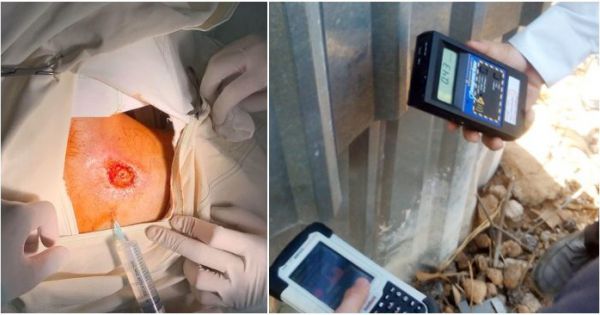 TP HCM truy tìm thiết bị X-quang nghi gây bức xạ