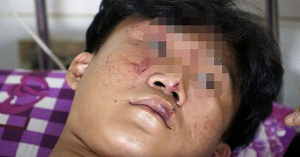 Khởi tố 8 đối tượng vào trường bắt 3 học sinh ra ngoài hành hung dã man tại Đồng Tháp