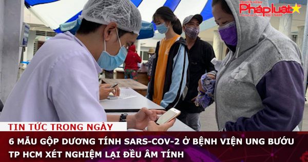 6 mẫu gộp dương tính SARS-Cov-2 ở Bệnh viện Ung bướu TP HCM xét nghiệm lại đều âm tính