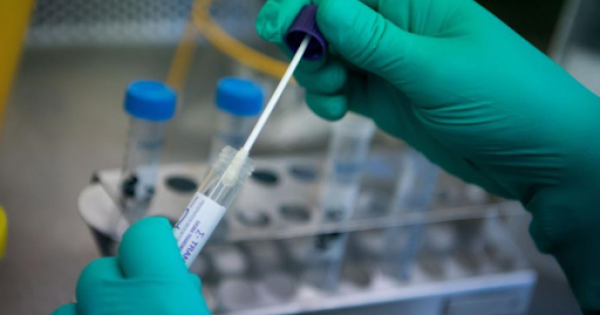 Bộ Y tế yêu cầu tăng cường giám sát, bảo đảm chất lượng xét nghiệm SARS-CoV-2