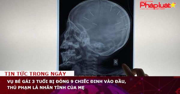 Vụ bé gái 3 tuổi bị đóng 9 chiếc đinh vào đầu, thủ phạm là nhân tình của mẹ